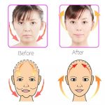 V Shape Face Shaper - Image 4