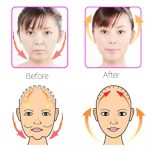 V Shape Face Shaper - Image 4